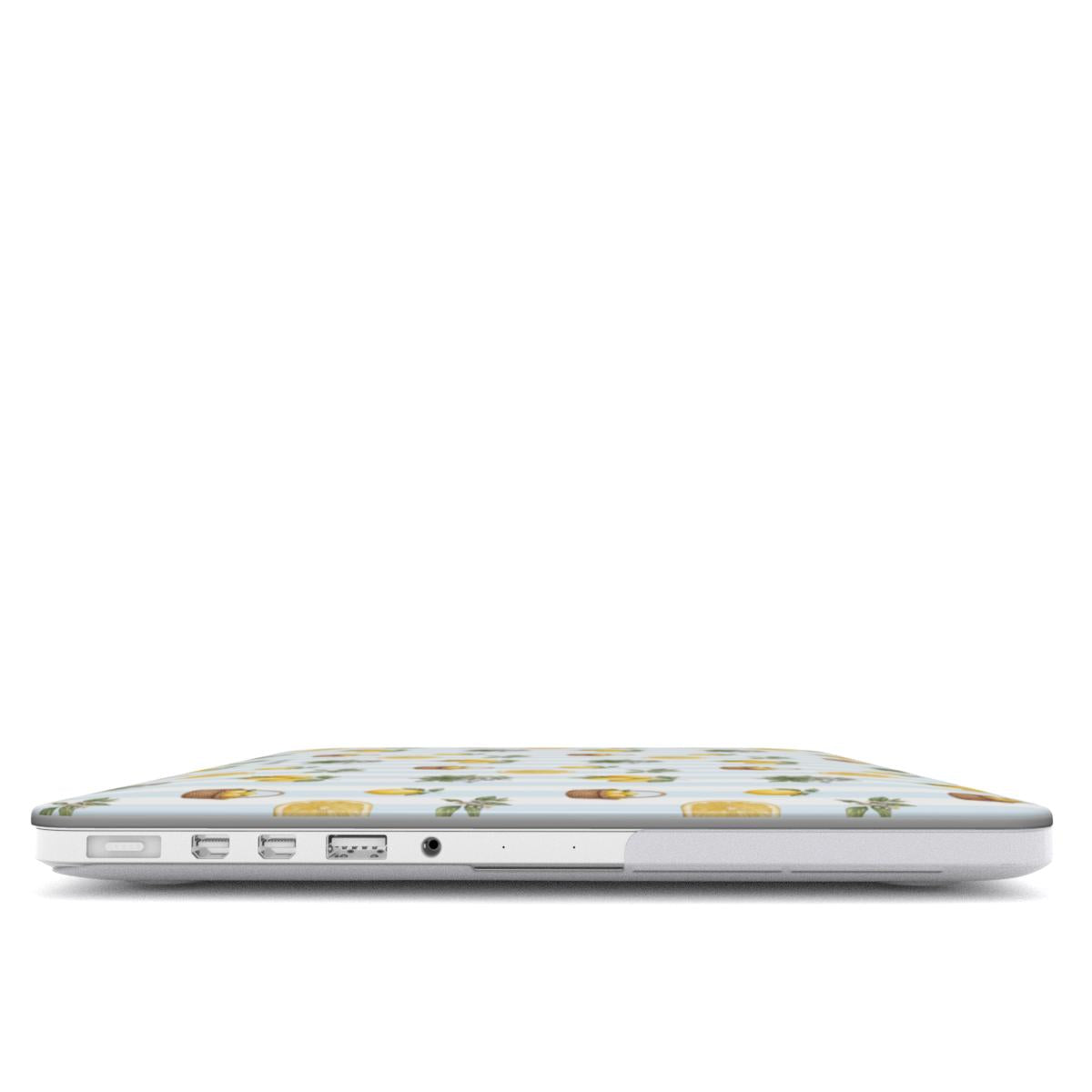 Summer Harvest | Zeste de Soleil | MacBook Case
