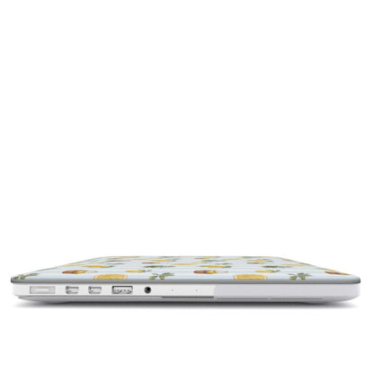 Summer Harvest | Zeste de Soleil | MacBook Case