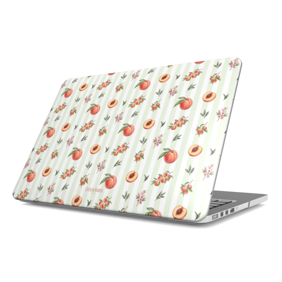Summer Harvest | Chair de Soleil | MacBook Case