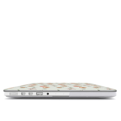 Summer Harvest | Chair de Soleil | MacBook Case